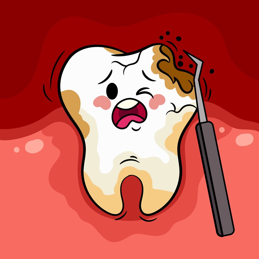 Tooth Decay