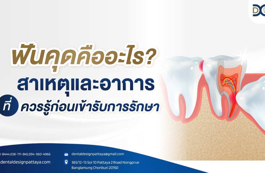 ฟันคุดคืออะไร