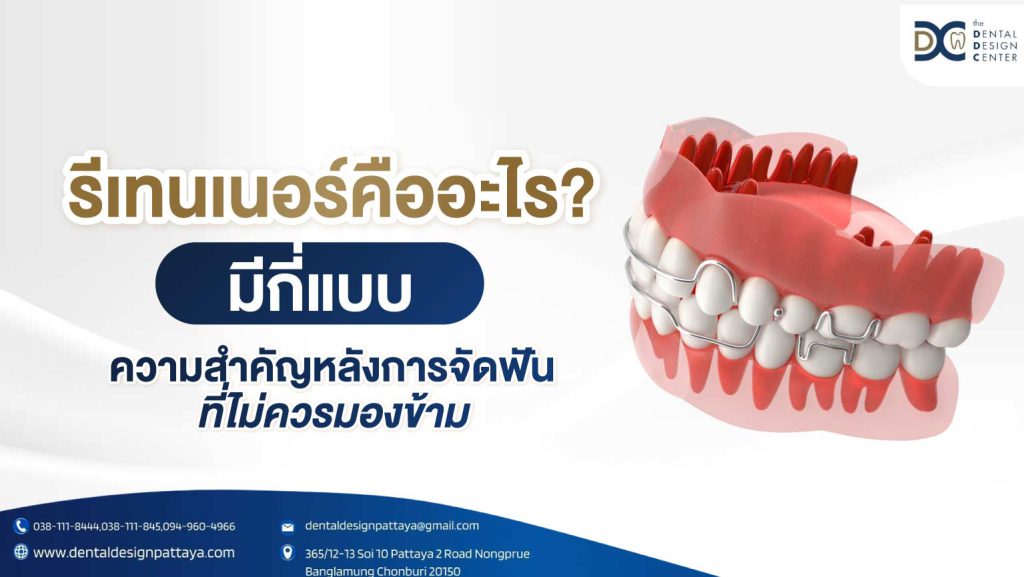 รีเทนเนอร์คืออะไร