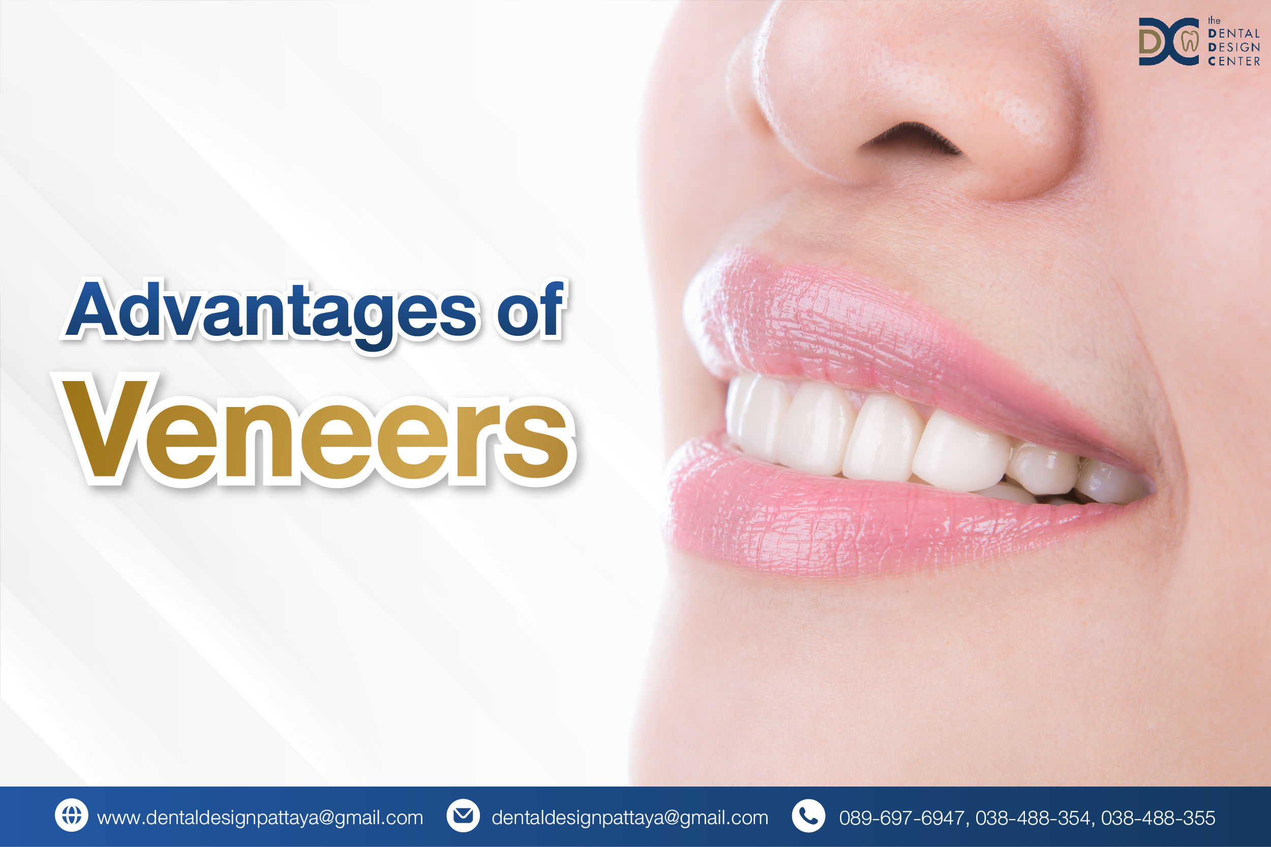 Transform Your Smile with Veneers at Dental Design Center Pattaya