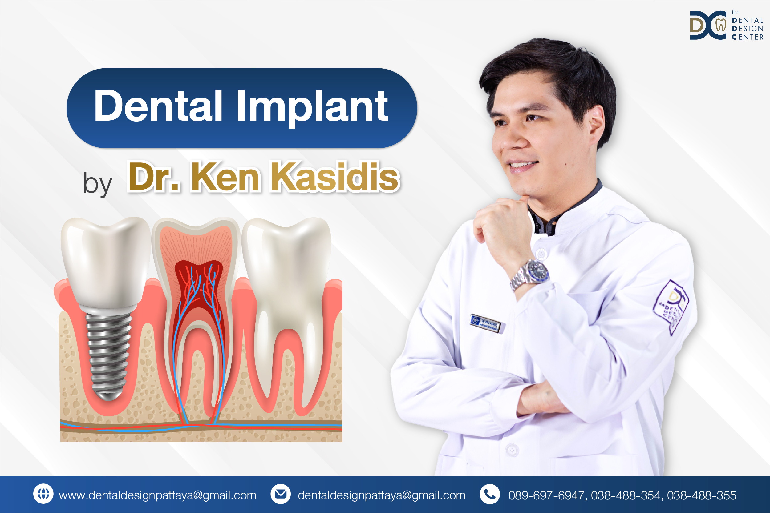 Dr. Ken Kasidis, expert in dental implants in Pattaya, explaining tooth implant structure.