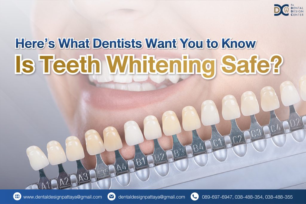 Is Teeth Whitening Safe? Expert Insights from a Dentist in Pattaya 1 Web Is Teeth Whitening Safe 01