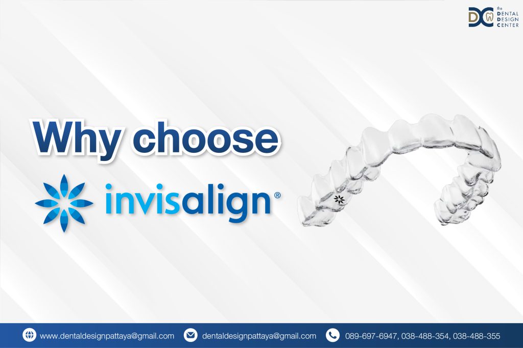 Why Choose Invisalign? A Clear Path to a Better Smile in Pattaya 1 Web Why choose clear braces