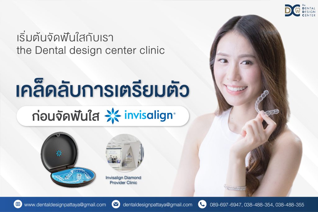 จัดฟันใส Invisalign ที่พัทยา – เคล็ดลับการเตรียมตัวก่อนเริ่มรักษา 1 Web จัดฟันใส 01