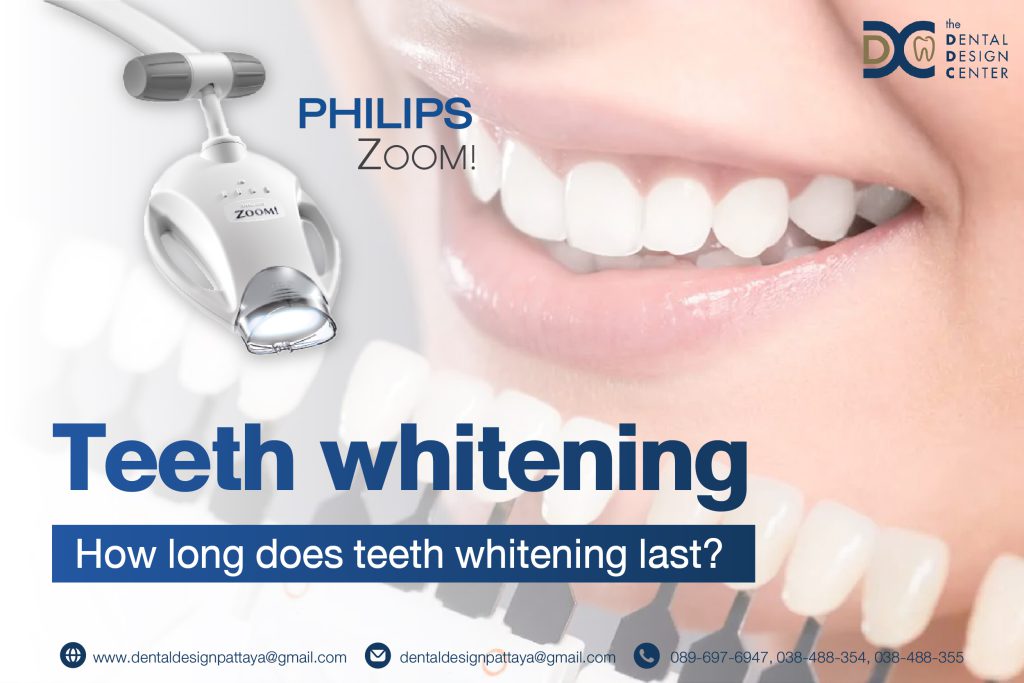Professional Teeth Whitening in Pattaya – How Long Does It Last? 1 web ฟอกสีฟัน 01