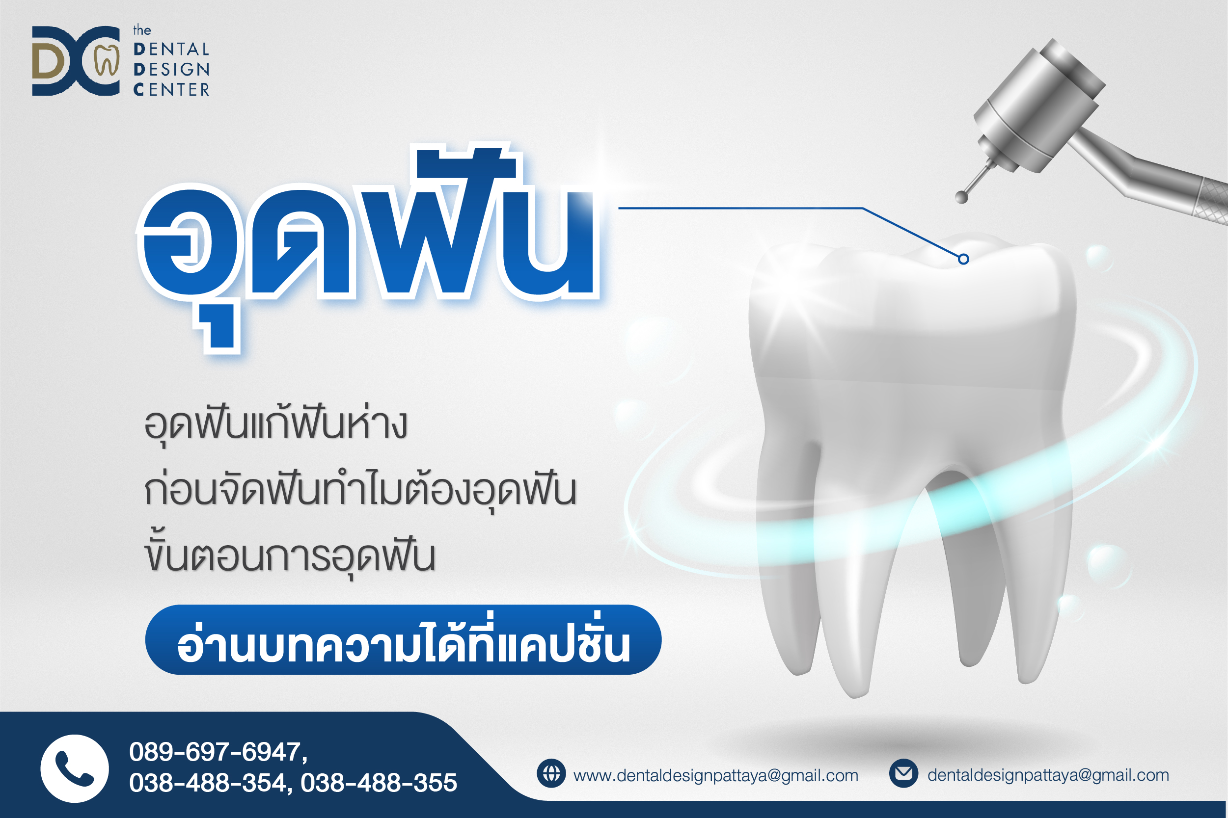 อุดฟัน-02 อุดฟัน 02