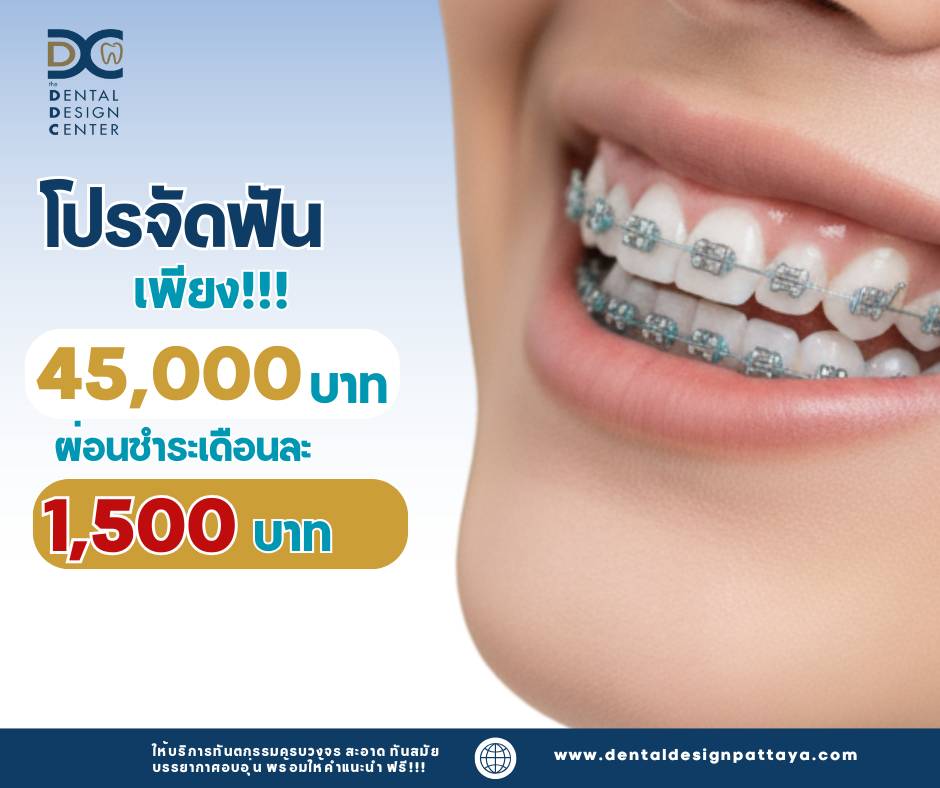 the Dental Design Center – Dentist Pattaya / Dental Clinic in Pattaya Thailand 17 53433