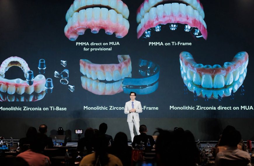 ART MEETS IMPLANTOLOGY: THE SCIENCE BEHIND THE ALL-ON-X SMILE
